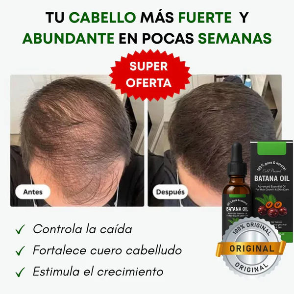 Aceite Batana : El Secreto Ancestral para Prevenir la Caída del Cabello y Estimular el Crecimiento